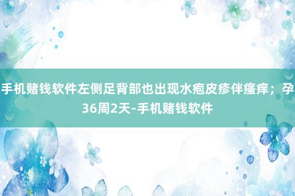手机赌钱软件左侧足背部也出现水疱皮疹伴瘙痒；孕36周2天-手机赌钱软件